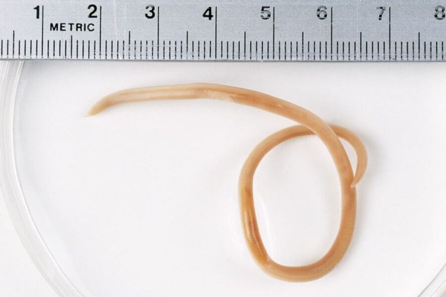 Ascaris ist ein runder Wurm, der im menschlichen Körper lebt